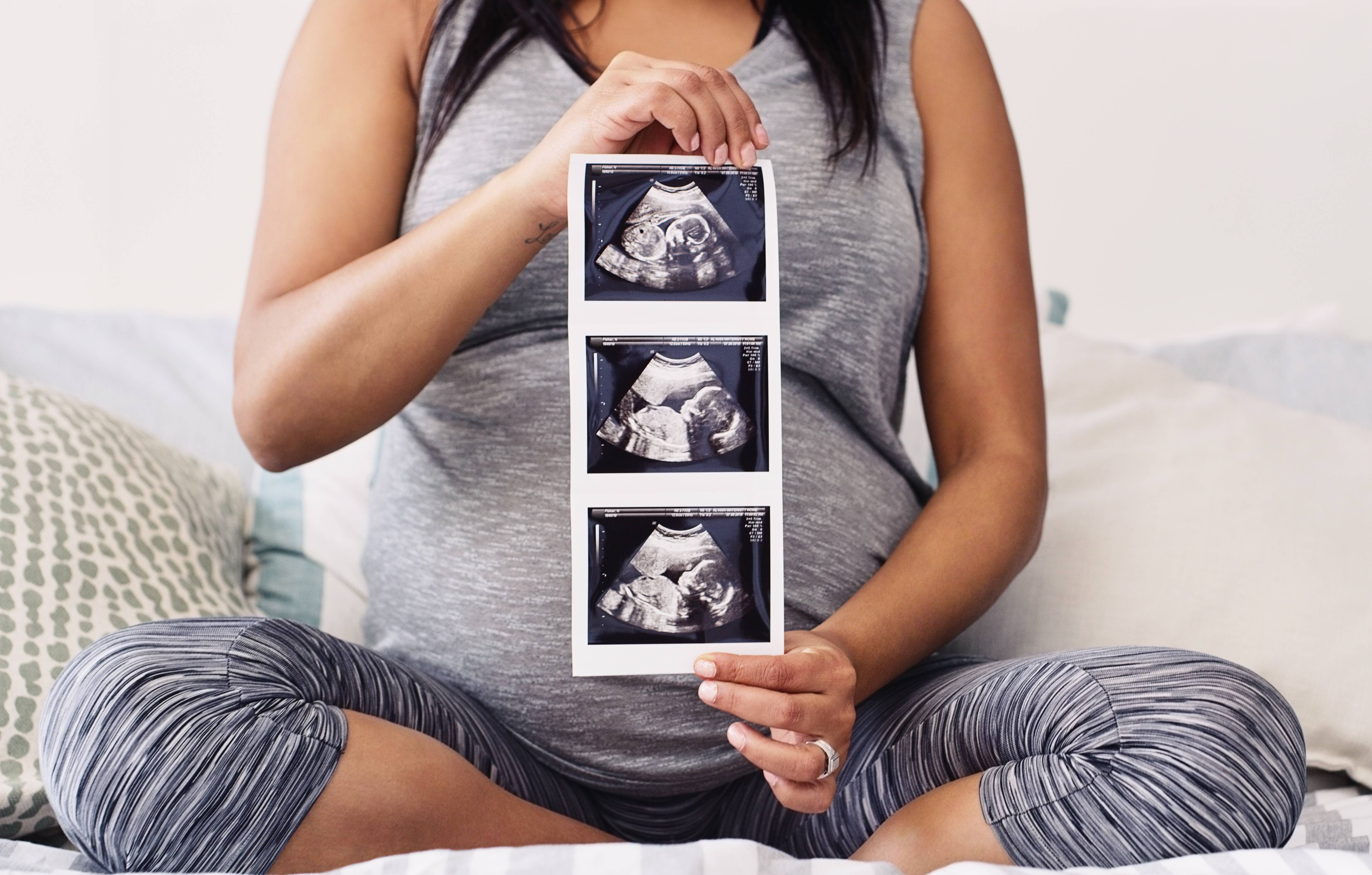 pregnant woman